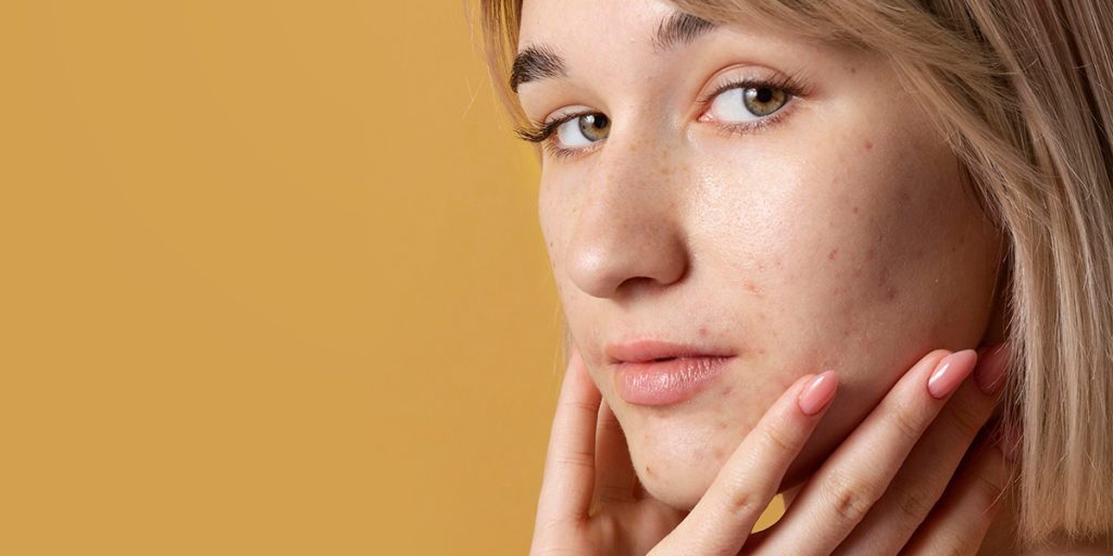 Guia de clareador de manchas